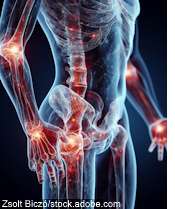 Pain and inflammation in human body joint 3d ai generated image
